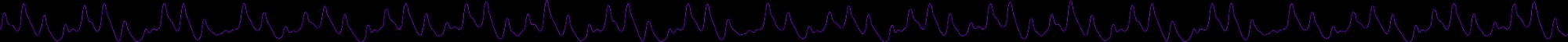 Raw photoplethysmography tracing showing pulsus paradoxus, pulse amplitude rising and falling with the breathing cycle